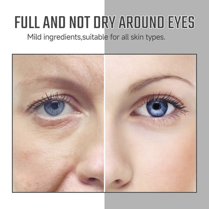 Instant Eye Care Solution Reduces Dark Circles